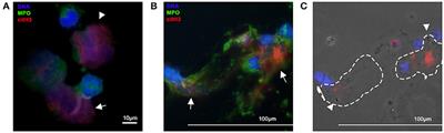 A Comparative Review of Neutrophil Extracellular Traps in Sepsis